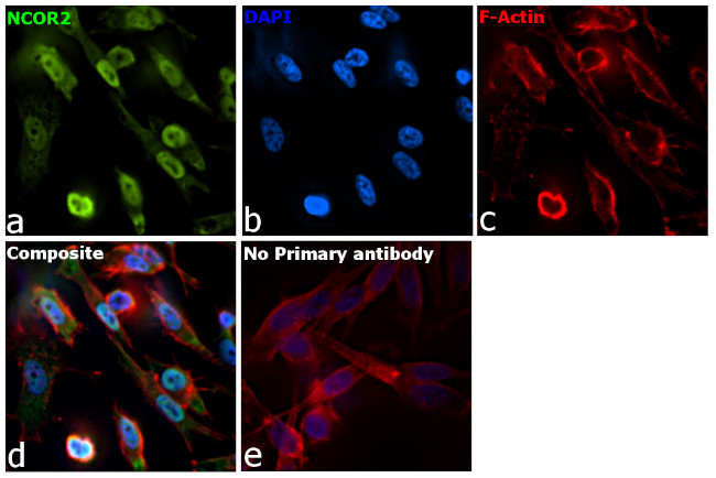 NCoR2 Antibody in Immunocytochemistry (ICC/IF)