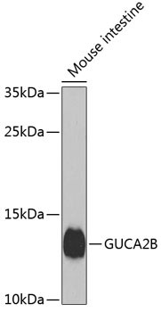 GUCA2B Antibody in Western Blot (WB)