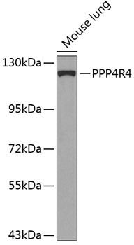 PPP4R4 Antibody in Western Blot (WB)
