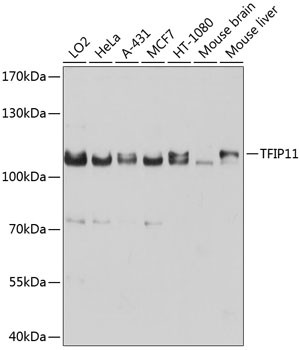 TFIP11 Antibody in Western Blot (WB)