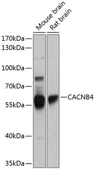 Calcium Channel beta-4 Antibody in Western Blot (WB)