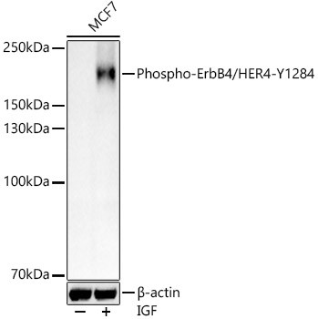 Phospho-ErbB4 (Tyr1284) Antibody in Western Blot (WB)