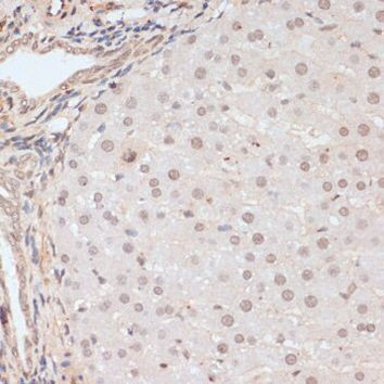 Phospho-BRCA1 (Ser1423) Antibody in Immunohistochemistry (Paraffin) (IHC (P))