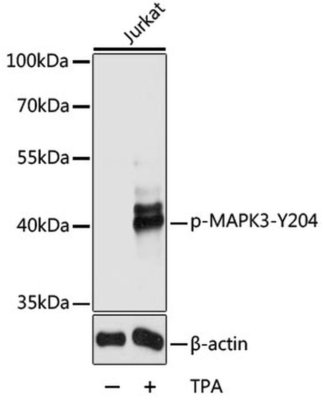 Phospho-ERK1 (Tyr204) Antibody in Western Blot (WB)