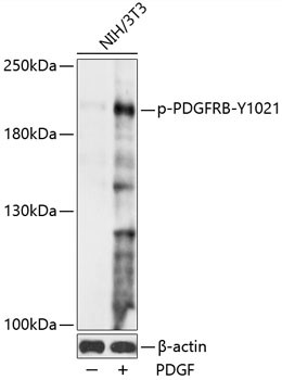 Phospho-PDGFRB (Tyr1021) Antibody in Western Blot (WB)