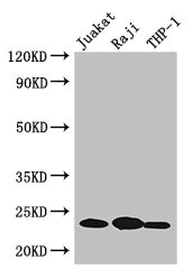 D4-GDI Antibody in Western Blot (WB)