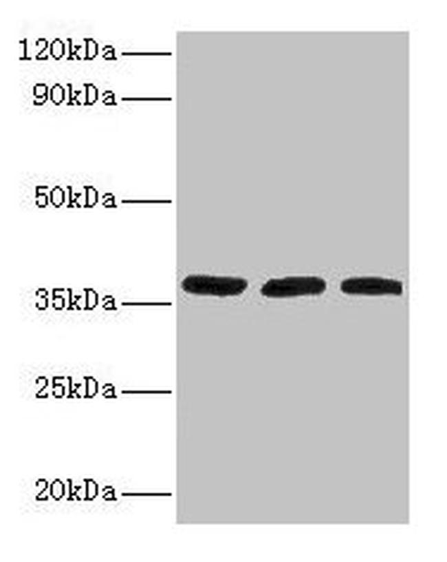 FTSJ1 Antibody in Western Blot (WB)