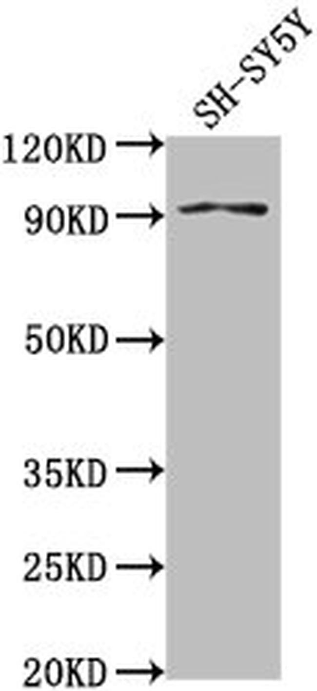 GPLD1 Antibody in Western Blot (WB)