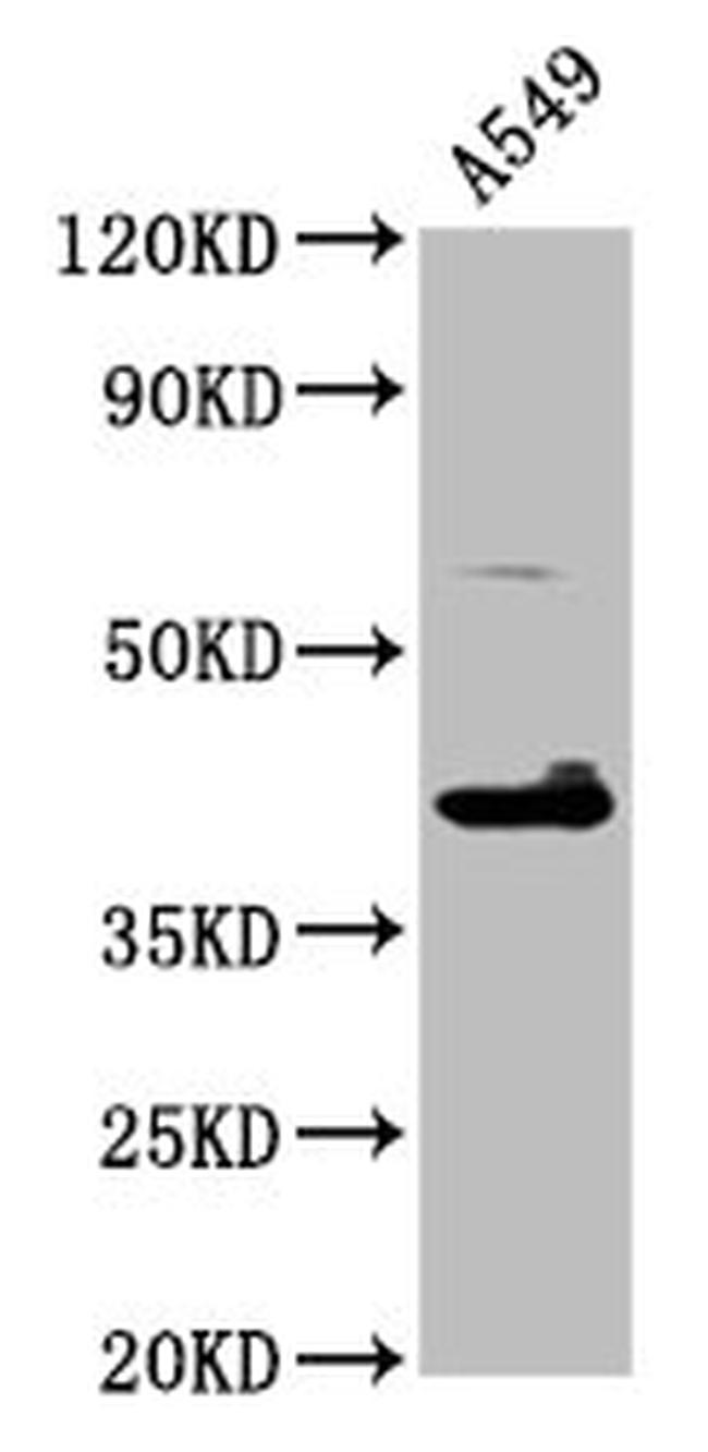 TFB1M Antibody in Western Blot (WB)