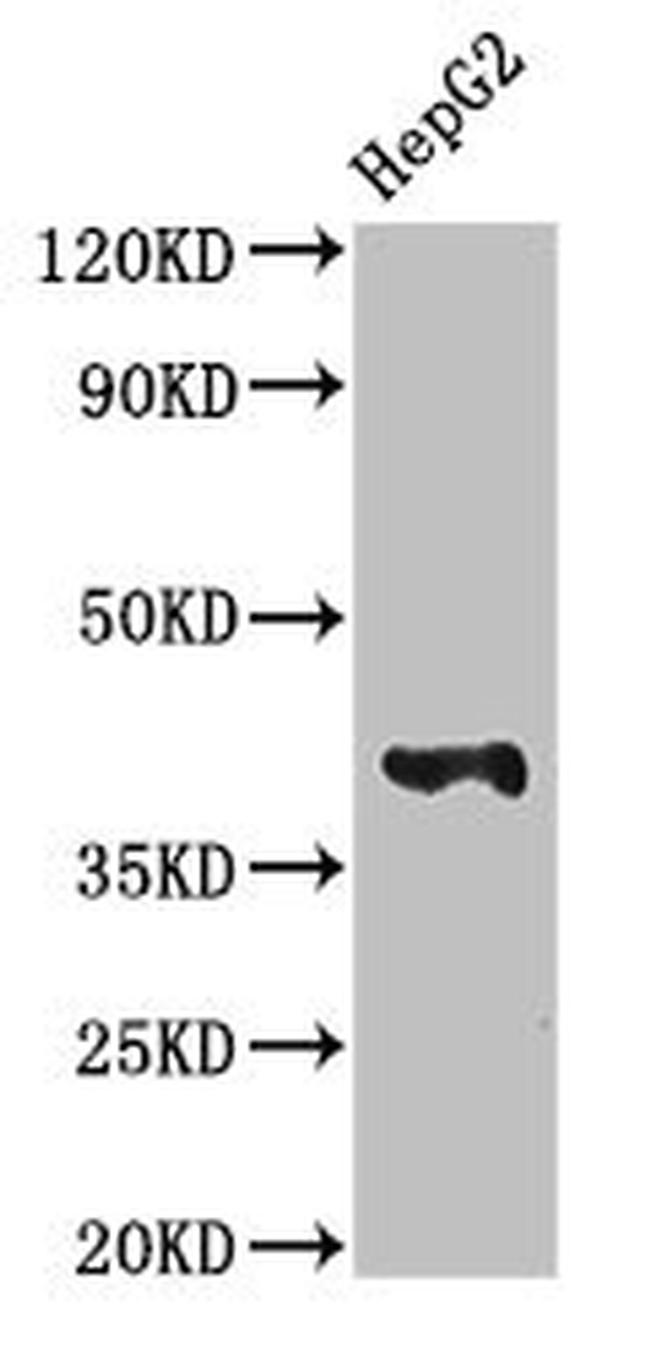 MAdCAM-1 Antibody in Western Blot (WB)
