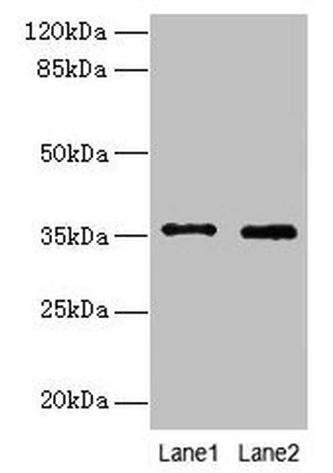 FOXR2 Antibody in Western Blot (WB)