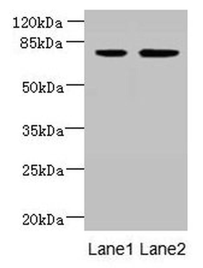 ARMC9 Antibody in Western Blot (WB)