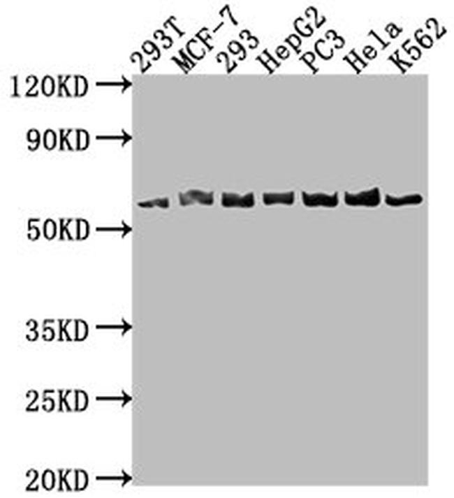 APCDD1 Antibody in Western Blot (WB)