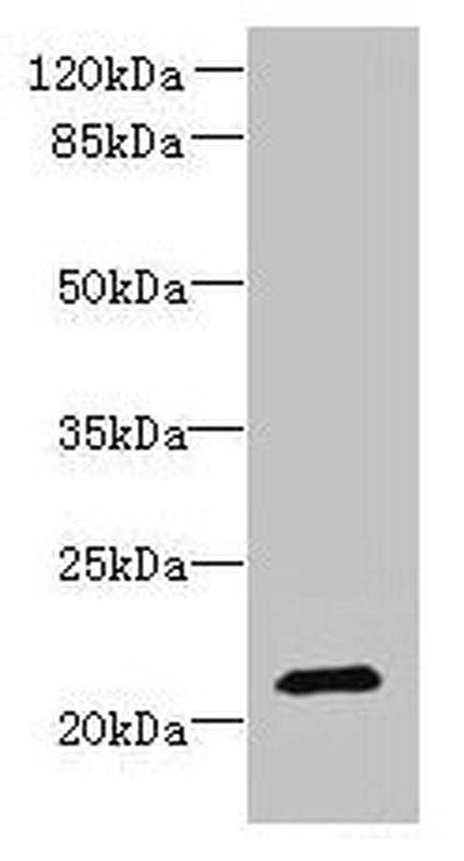 DYDC1 Antibody in Western Blot (WB)