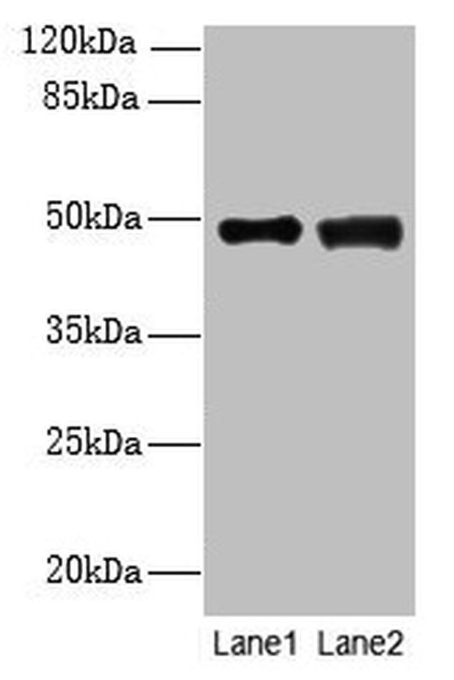 DBF4B Antibody in Western Blot (WB)