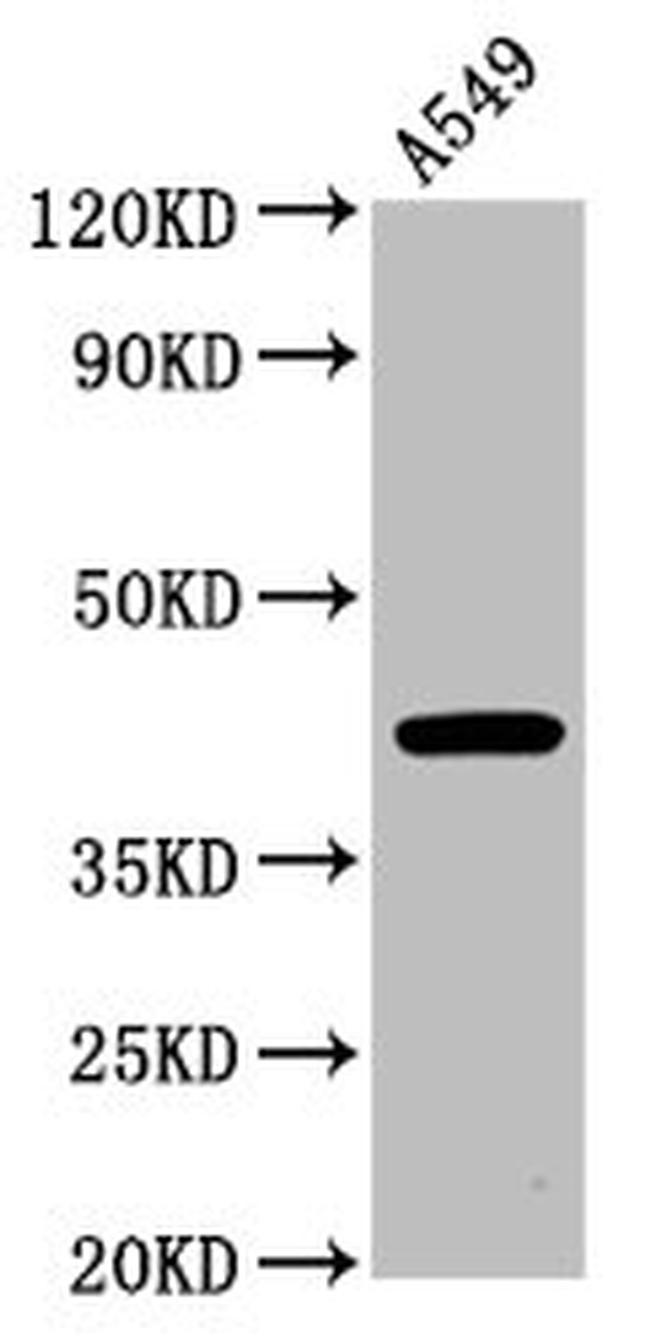 CHST14 Antibody in Western Blot (WB)