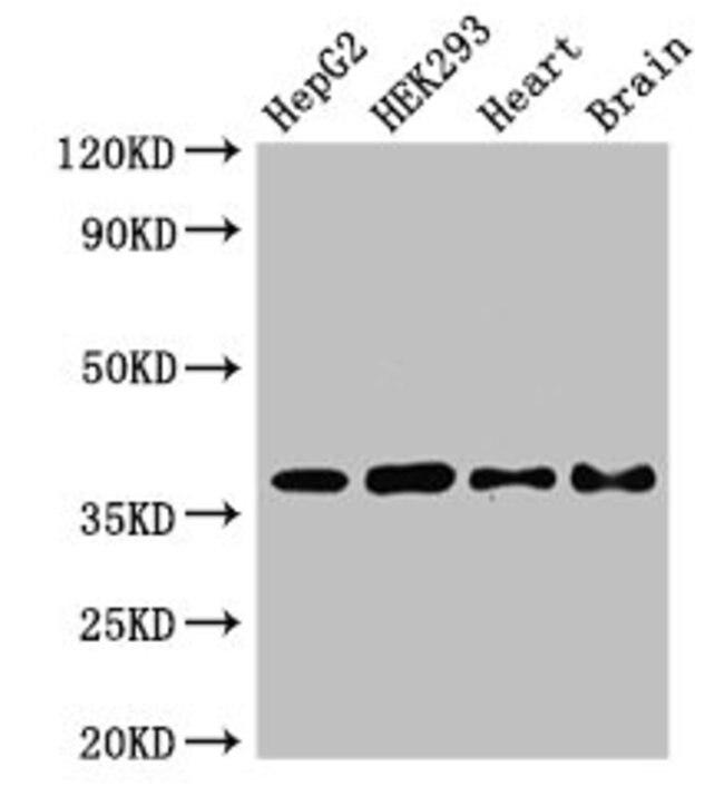 PNKD Antibody in Western Blot (WB)