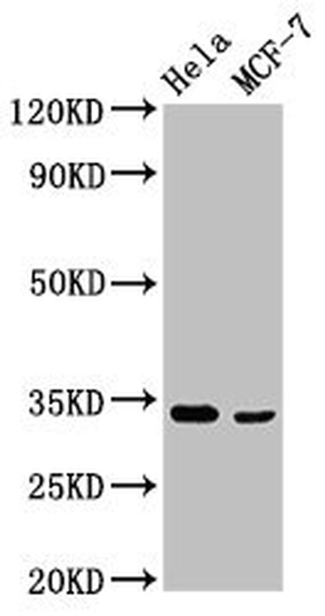 NFKBID Antibody in Western Blot (WB)