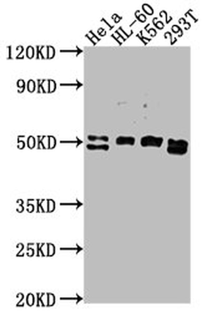DDX47 Antibody in Western Blot (WB)
