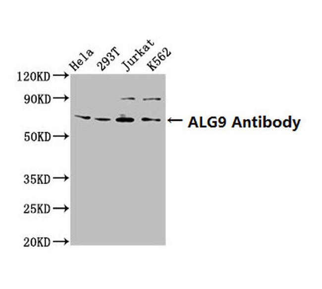 ALG9 Antibody in Western Blot (WB)