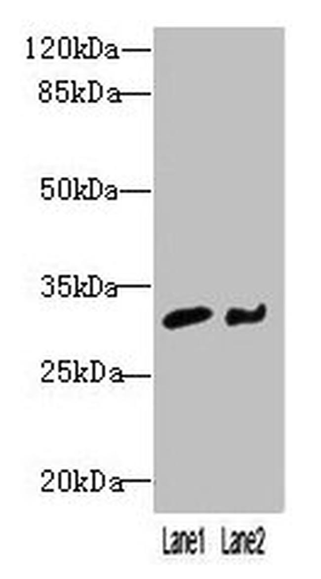 NIT2 Antibody in Western Blot (WB)