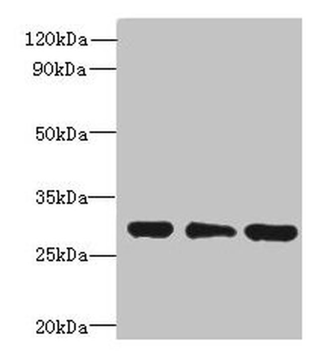 HDHD3 Antibody in Western Blot (WB)