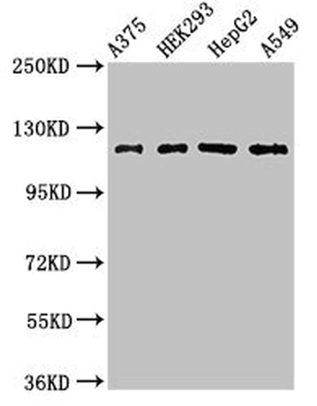 FARP1 Antibody in Western Blot (WB)