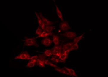 Phospho-ALOX5 (Ser523) Antibody in Immunocytochemistry (ICC/IF)