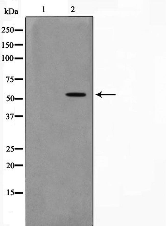 ZNF187 Antibody in Western Blot (WB)