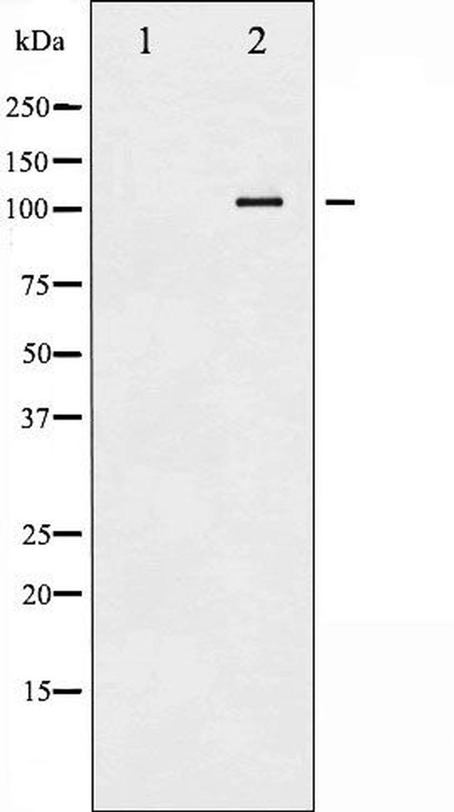 Phospho-ATP1A1 (Ser23) Antibody in Western Blot (WB)