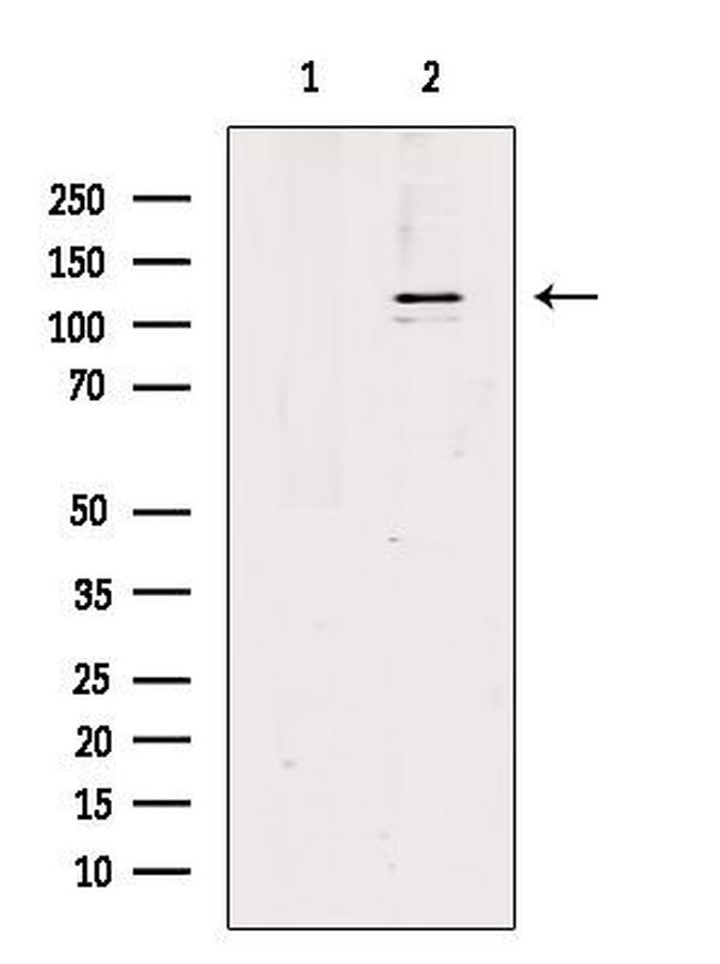 Phospho-iNOS (Tyr151) Antibody in Western Blot (WB)