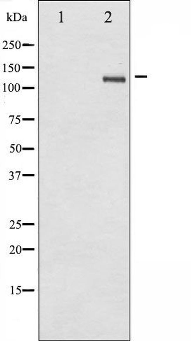 Phospho-SREBP1 (Ser439) Antibody in Western Blot (WB)