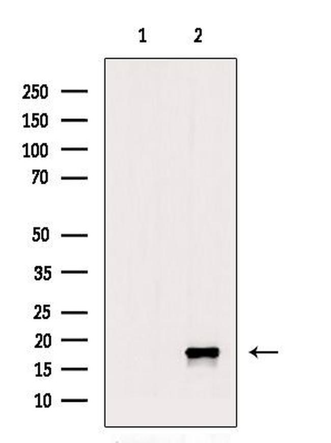 Phospho-Alpha-synuclein (Tyr136) Antibody in Western Blot (WB)