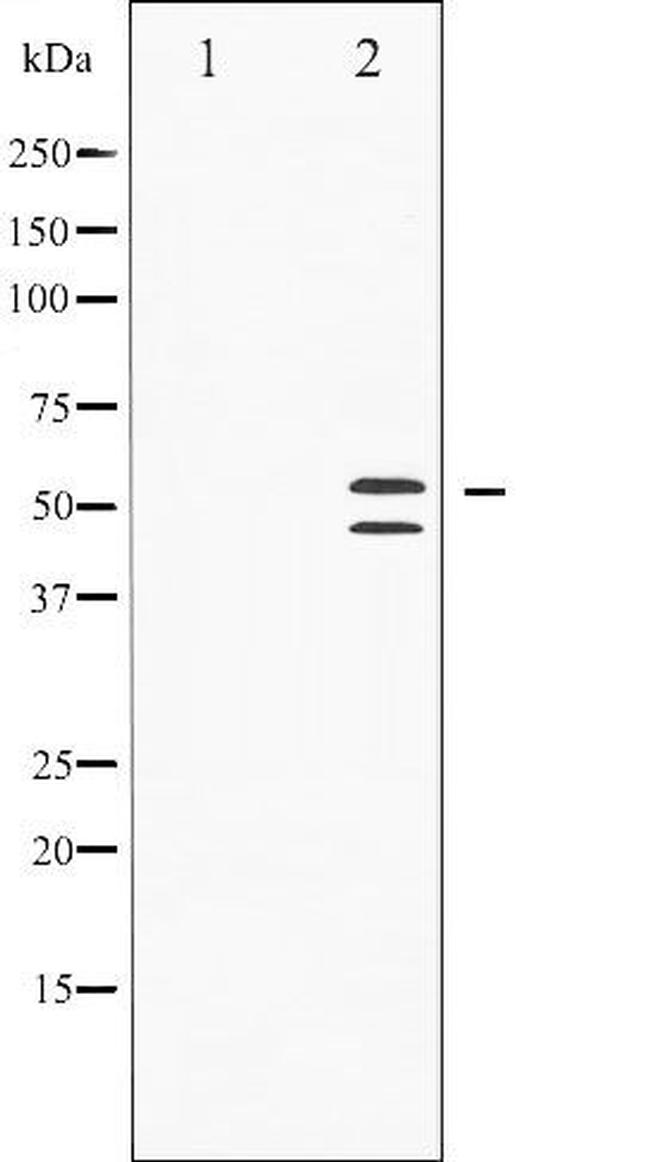 Phospho-JNK1/JNK2/JNK3 (Thr183) Antibody in Western Blot (WB)