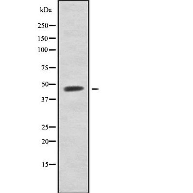 Acrosin Antibody in Western Blot (WB)