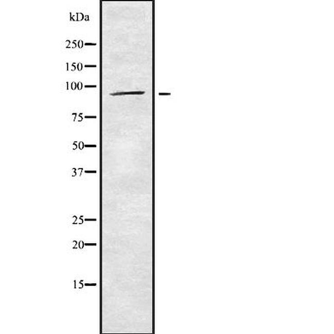 ST14 Antibody in Western Blot (WB)