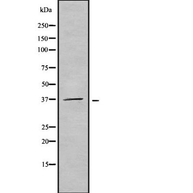 OR51F2 Antibody in Western Blot (WB)