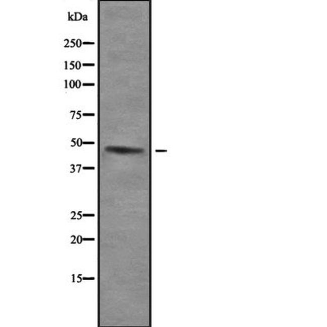 Uba5 Antibody in Western Blot (WB)