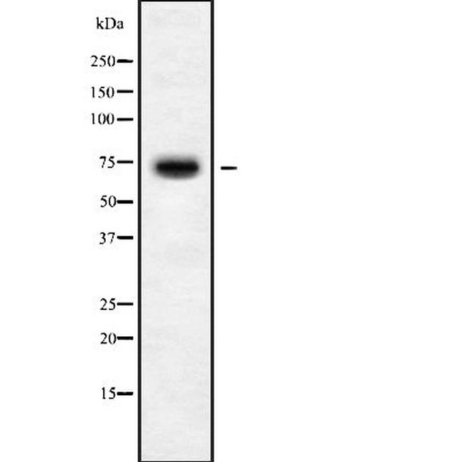 KLHL36 Antibody in Western Blot (WB)