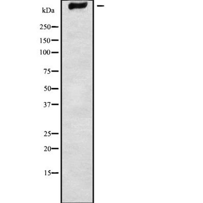 GPR98 Antibody in Western Blot (WB)