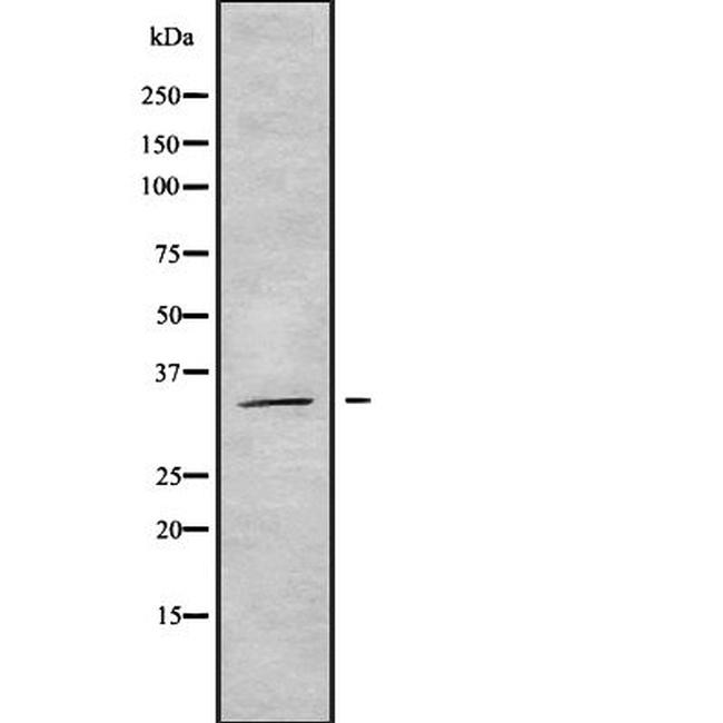 OR14A16 Antibody in Western Blot (WB)