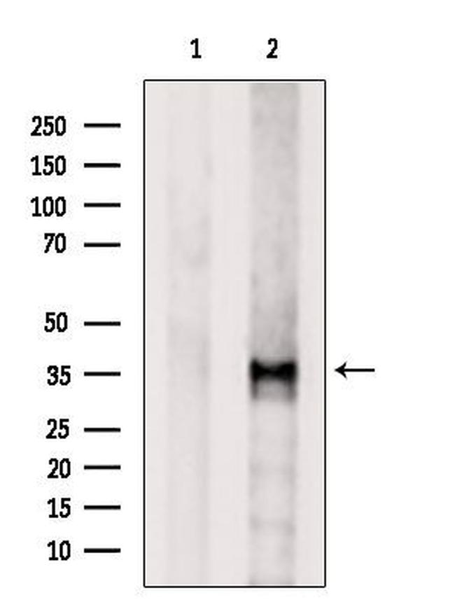 OR2B3 Antibody in Western Blot (WB)