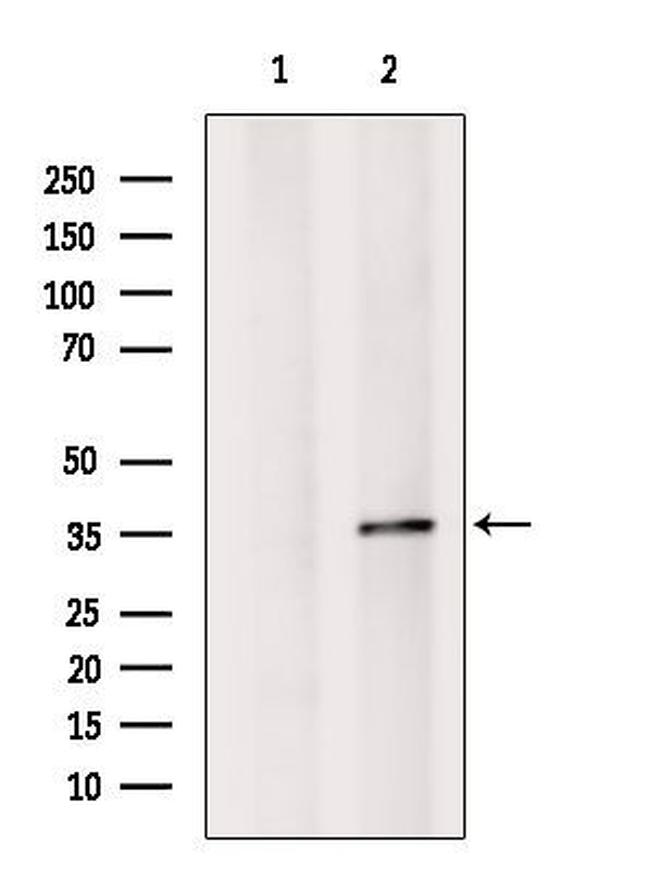 OR52K2 Antibody in Western Blot (WB)