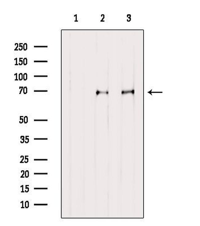 MKS1 Antibody in Western Blot (WB)
