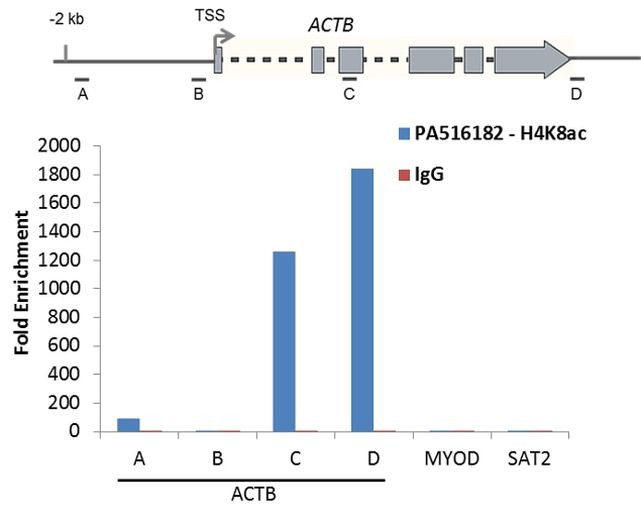 H4K8ac Antibody in ChIP Assay (ChIP)