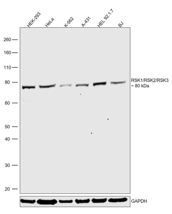 RSK1/RSK2/RSK3 Antibody in Western Blot (WB)