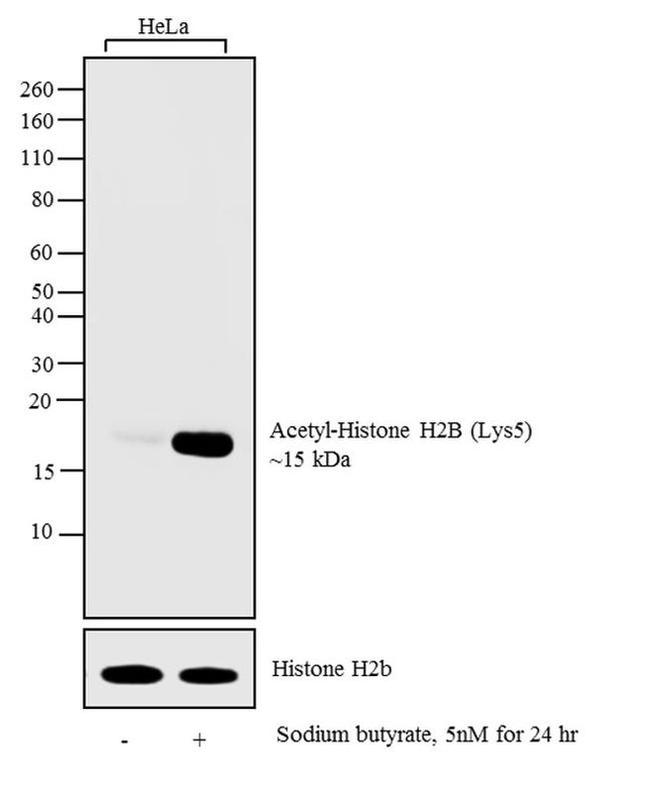 H2BK5ac Antibody in Western Blot (WB)