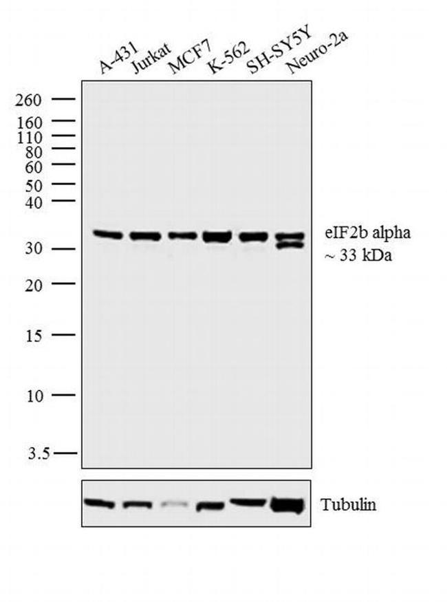 eIF2b alpha Antibody in Western Blot (WB)