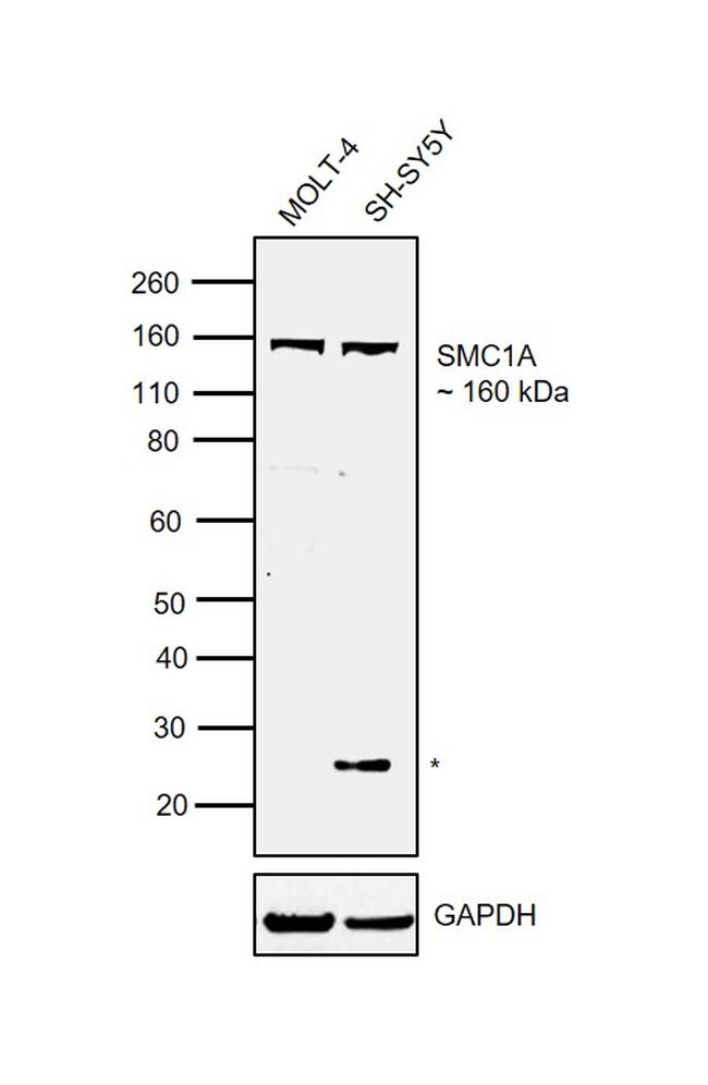 SMC1 Antibody in Western Blot (WB)