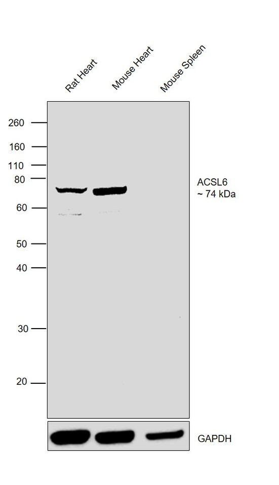 ACSL6 Antibody